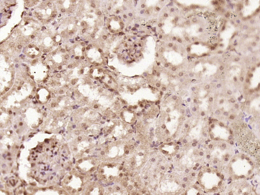 14 - CDKN2B/p15 INK4b Rabbit pAb AP58142