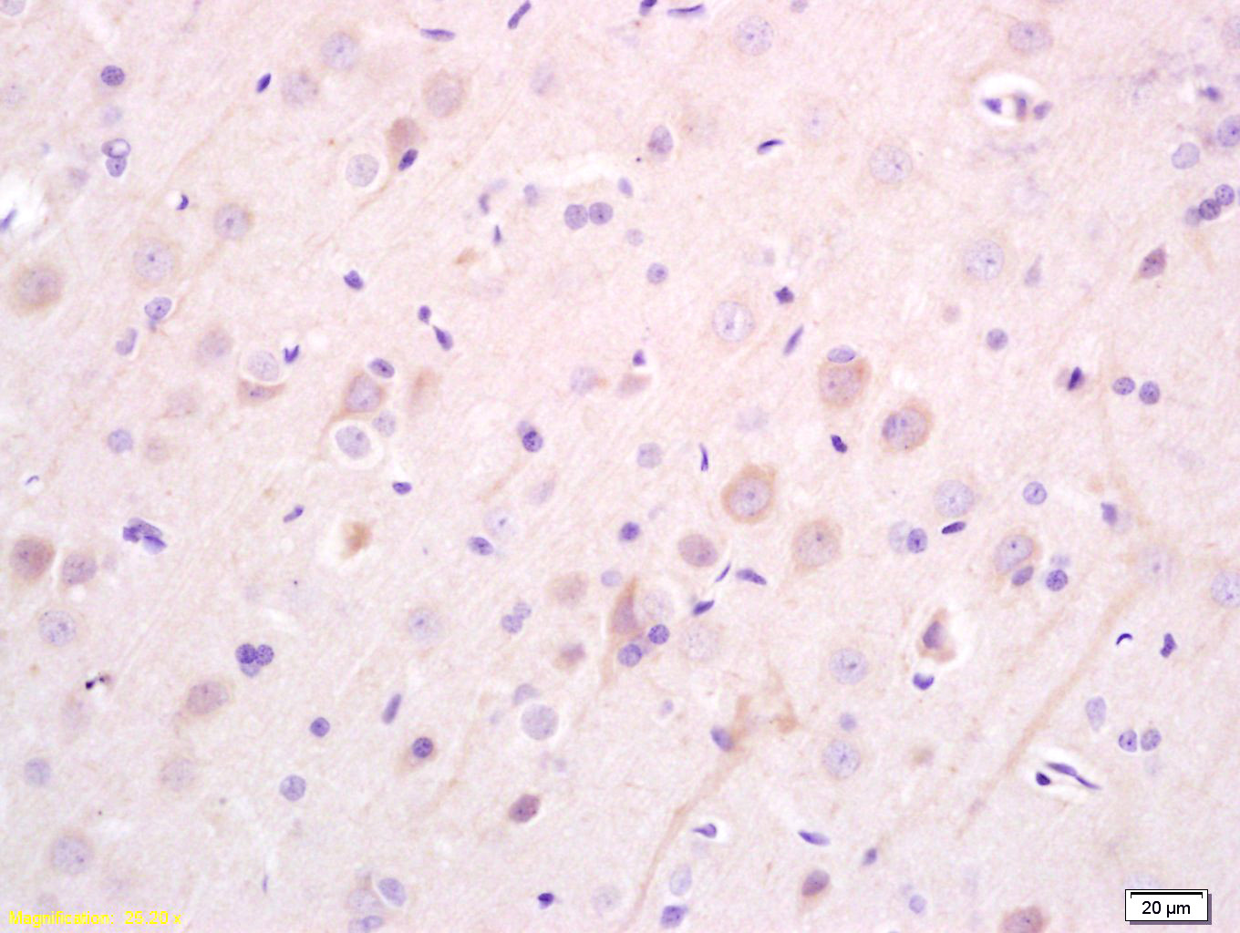 14 - EBF3 Rabbit pAb AP58145