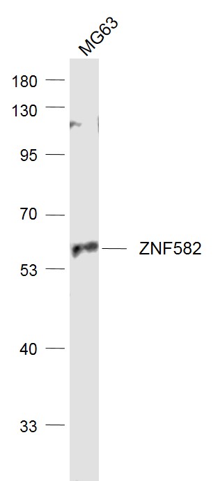 1 - ZNF582 Rabbit pAb AP58158