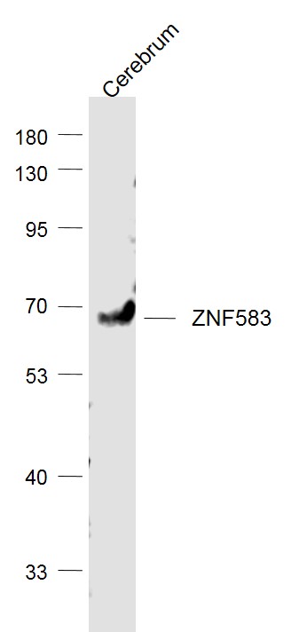 1 - ZNF583 Rabbit pAb AP58159