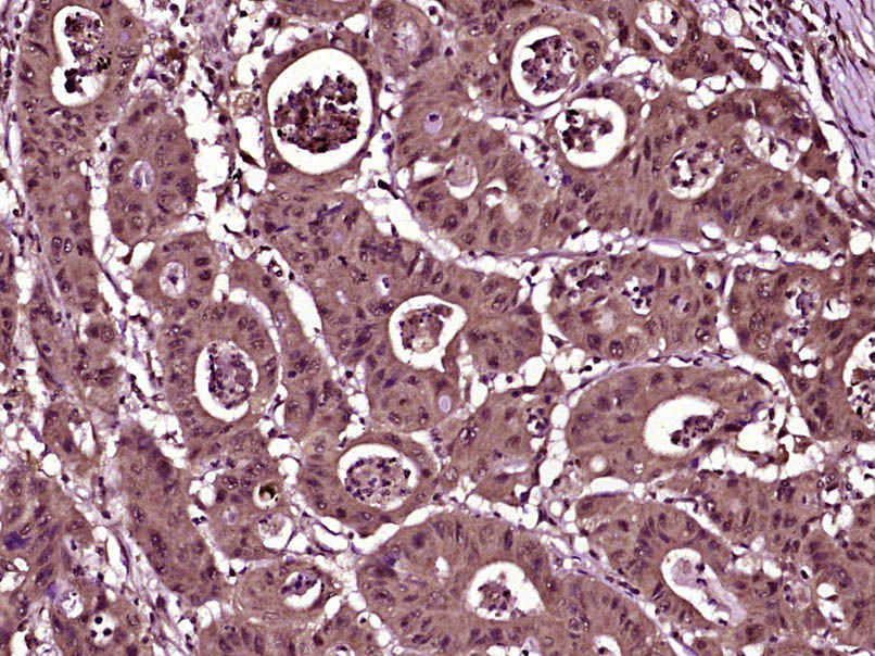 14 - ZNF583 Rabbit pAb AP58159