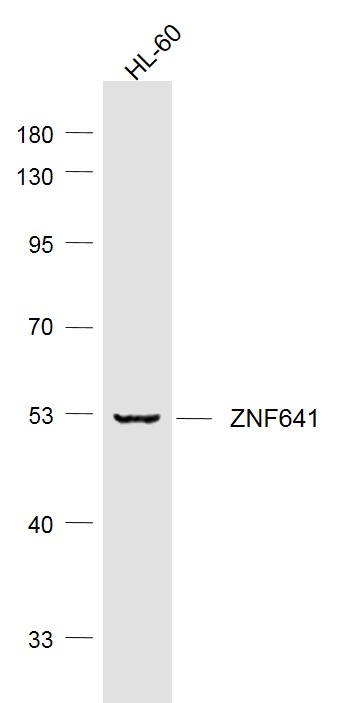 1 - ZNF641 Rabbit pAb AP58160