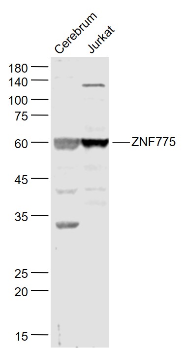 1 - ZNF775 Rabbit pAb AP58178