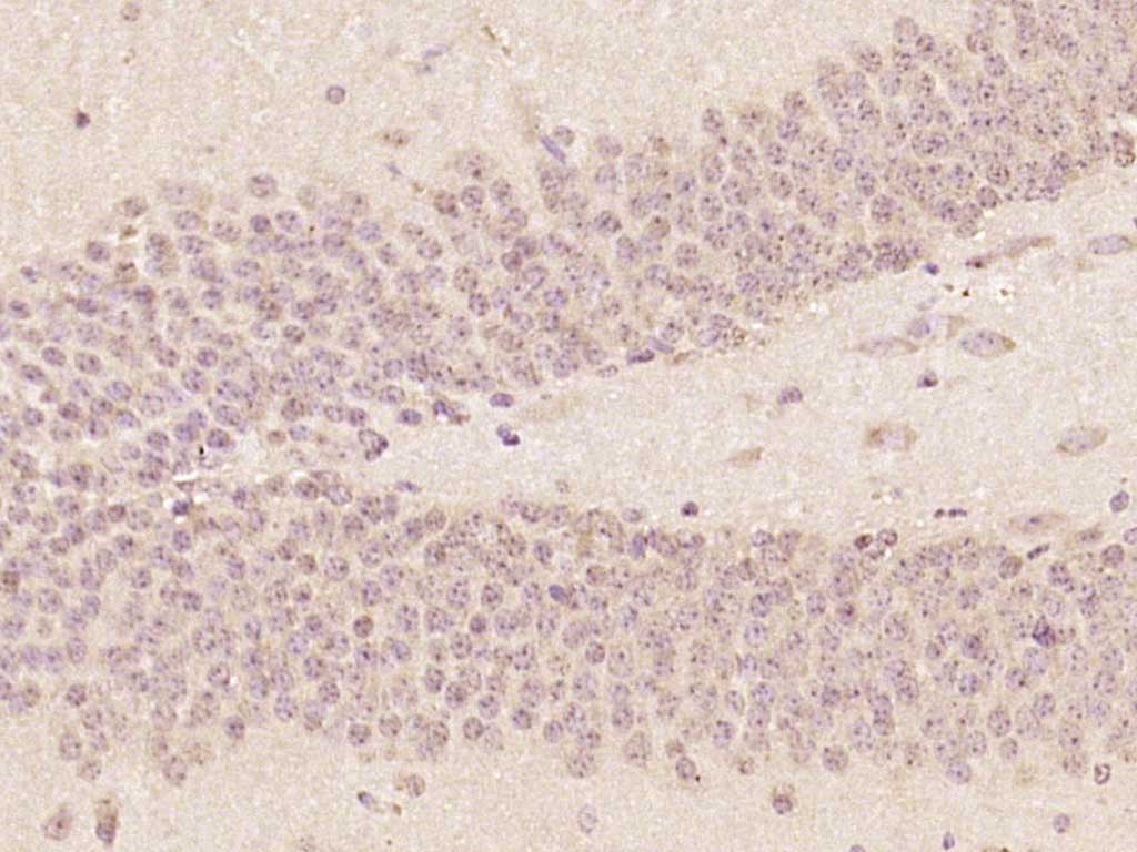 14 - ZNF775 Rabbit pAb AP58178