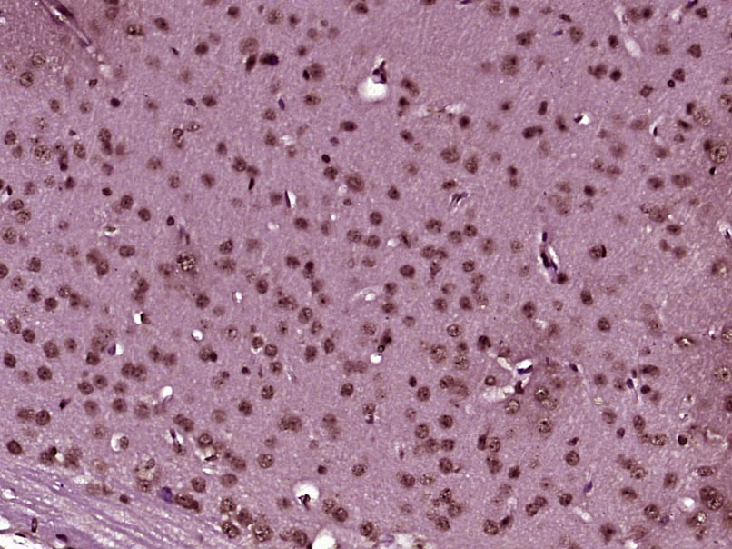 14 - ZMIZ2 Rabbit pAb AP58183