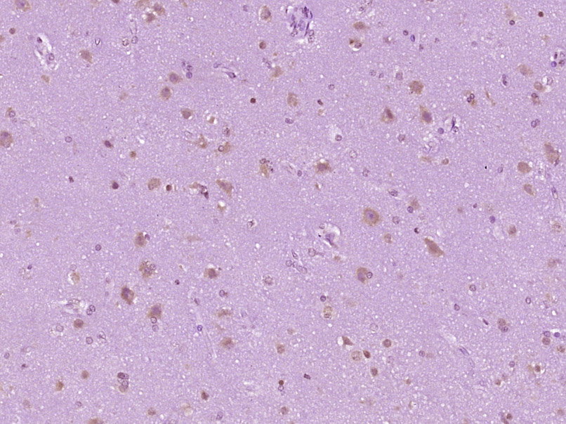 14 - ZMYND17 Rabbit pAb AP58185