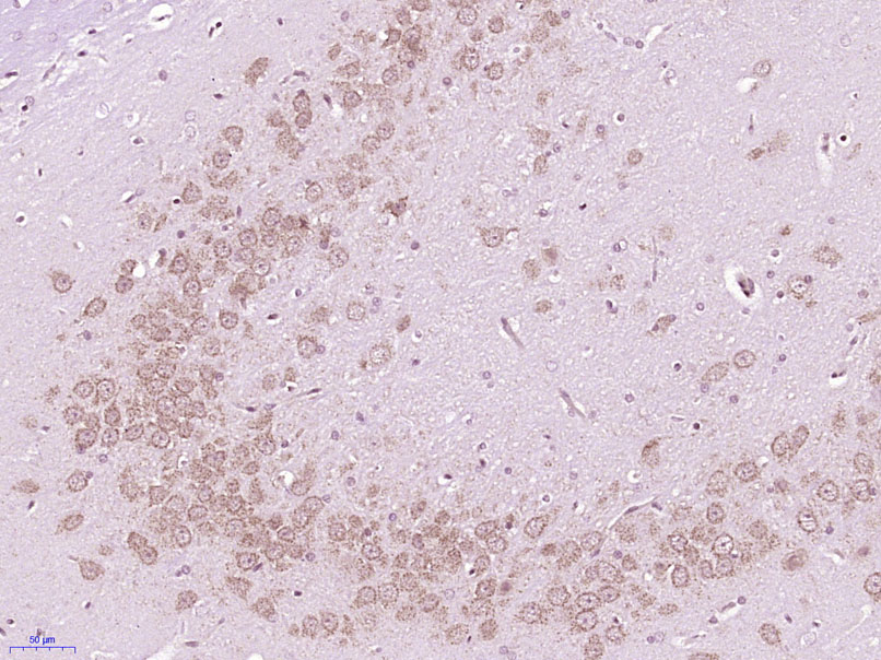 14 - NXT2 Rabbit pAb AP58191