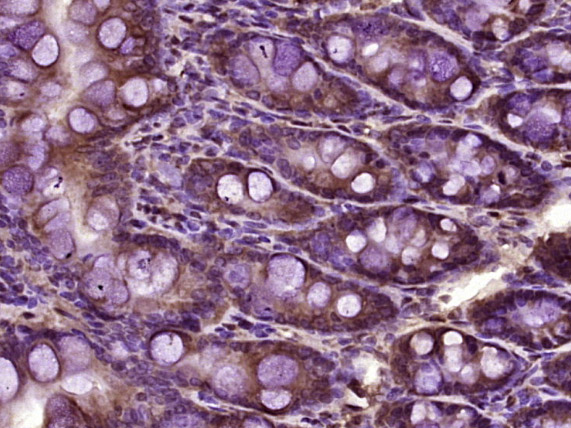 14 - PSTK Rabbit pAb AP58196