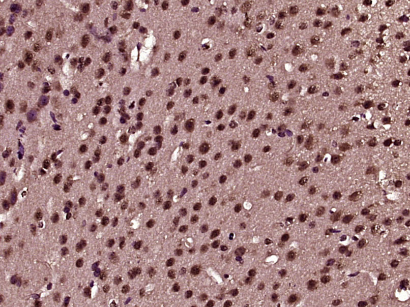 14 - PTPN18 Rabbit pAb AP58201