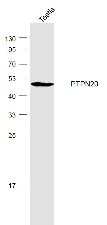 1 - PTPN20 Rabbit pAb AP58202