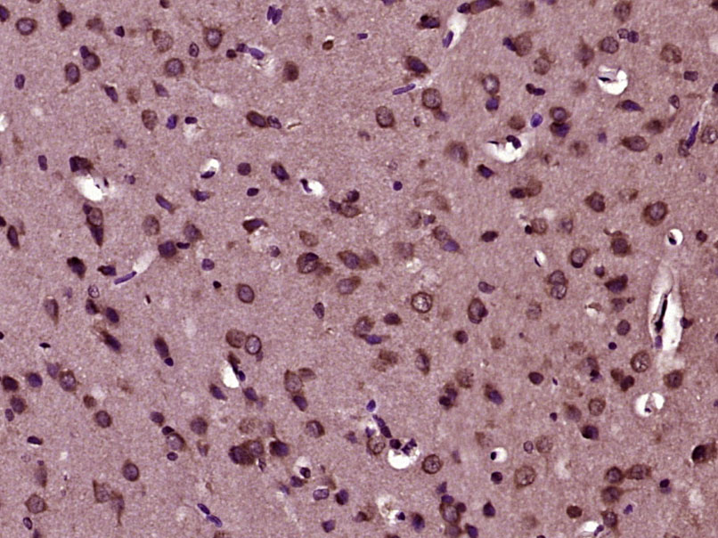 14 - PTPN20 Rabbit pAb AP58202