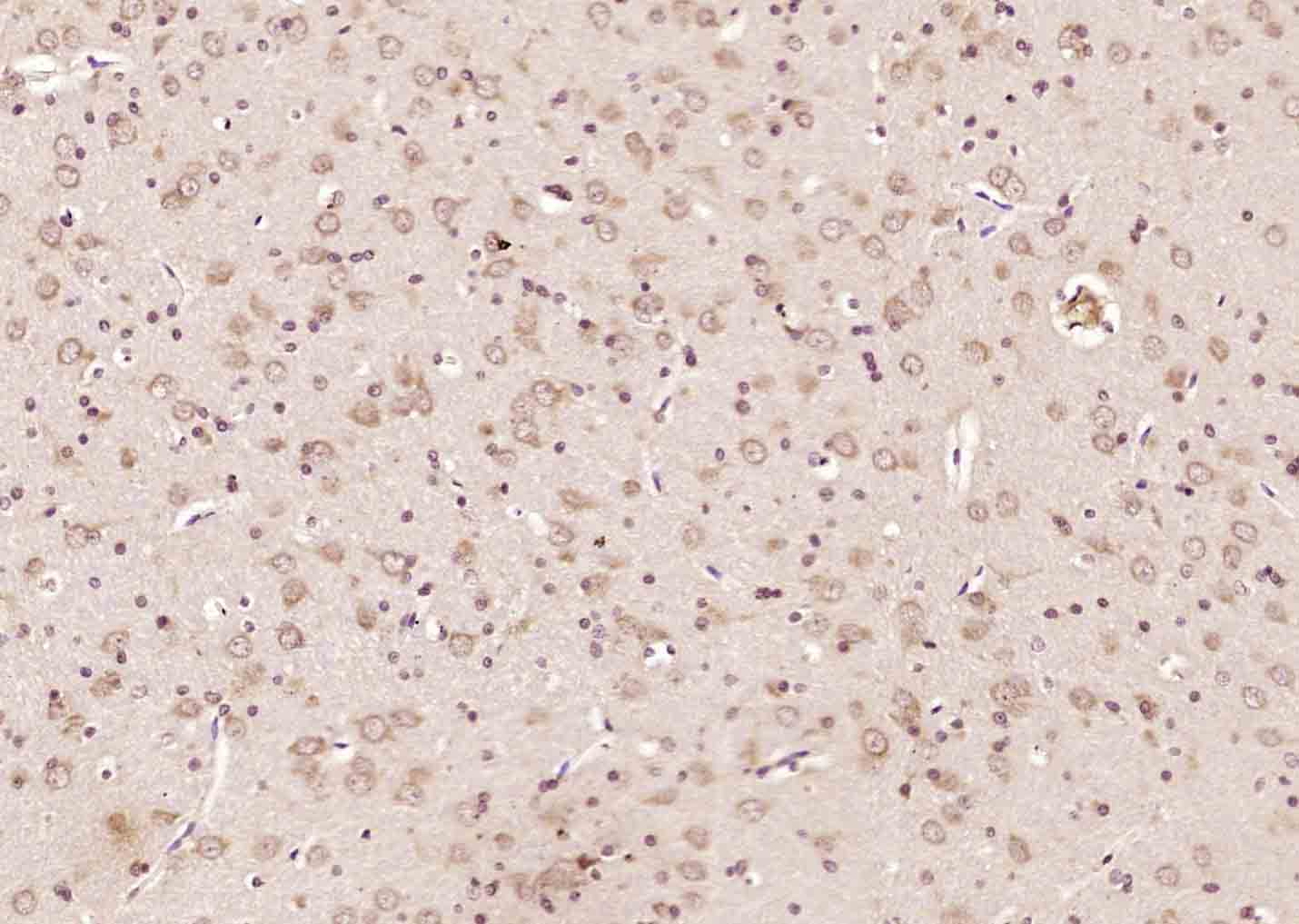 14 - PTRHD1 Rabbit pAb AP58203