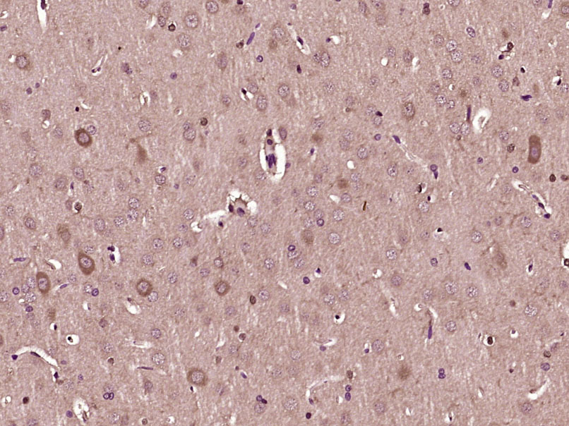 14 - STRC Rabbit pAb AP58220