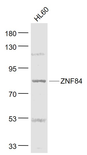 1 - ZNF84 Rabbit pAb AP58224