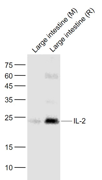 1 - IL-2 Rabbit pAb AP58236