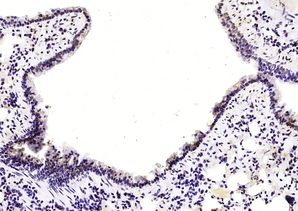 14 - CUEDC2 Rabbit pAb AP58237