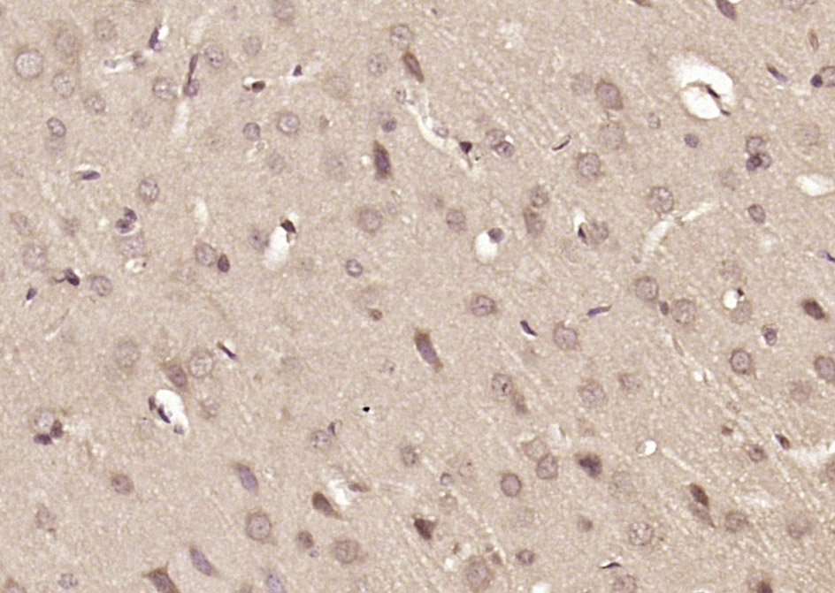 14 - ASB10 Rabbit pAb AP58239