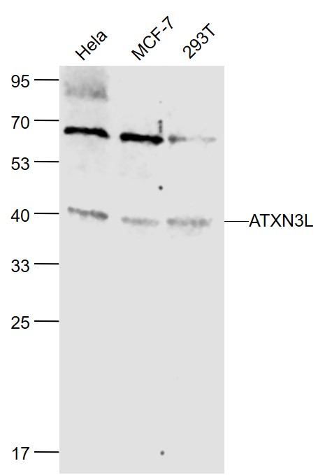 1 - ATXN3L Rabbit pAb AP58246