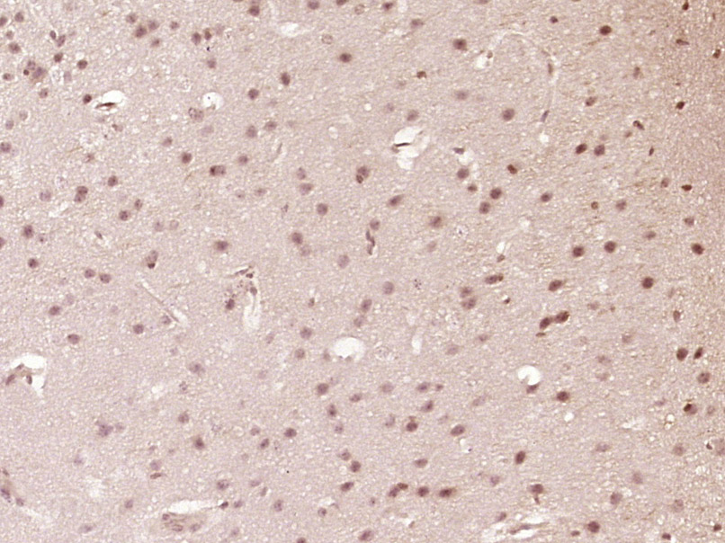 14 - SETBP1 Rabbit pAb AP58253