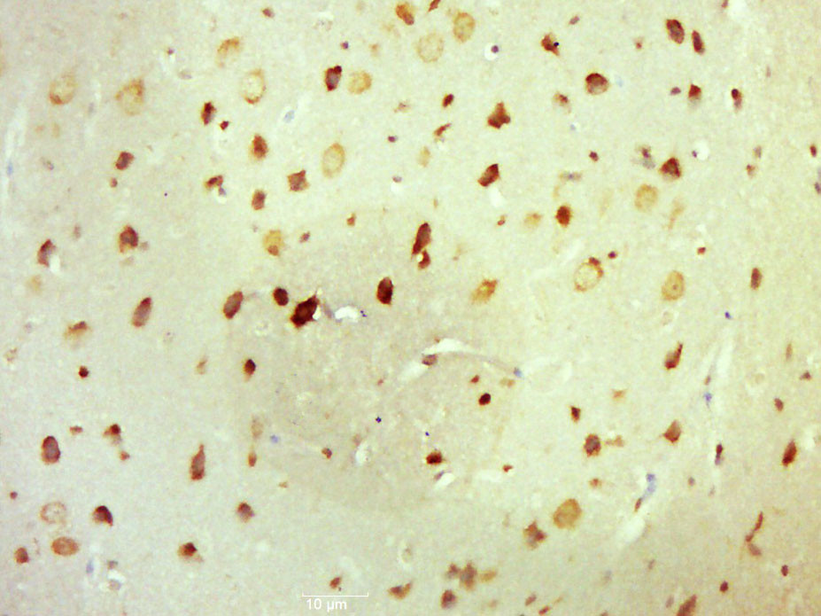 14 - Laminin alpha 1 Rabbit pAb AP58256