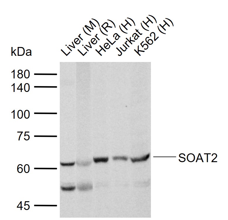 1 - SOAT2 Rabbit pAb AP58259