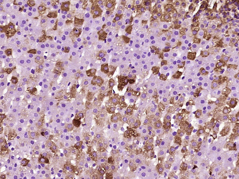 14 - SOAT2 Rabbit pAb AP58259