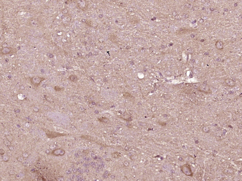 14 - COL4A3BP Rabbit pAb AP58267