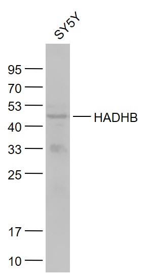 1 - HADHB Rabbit pAb AP58270