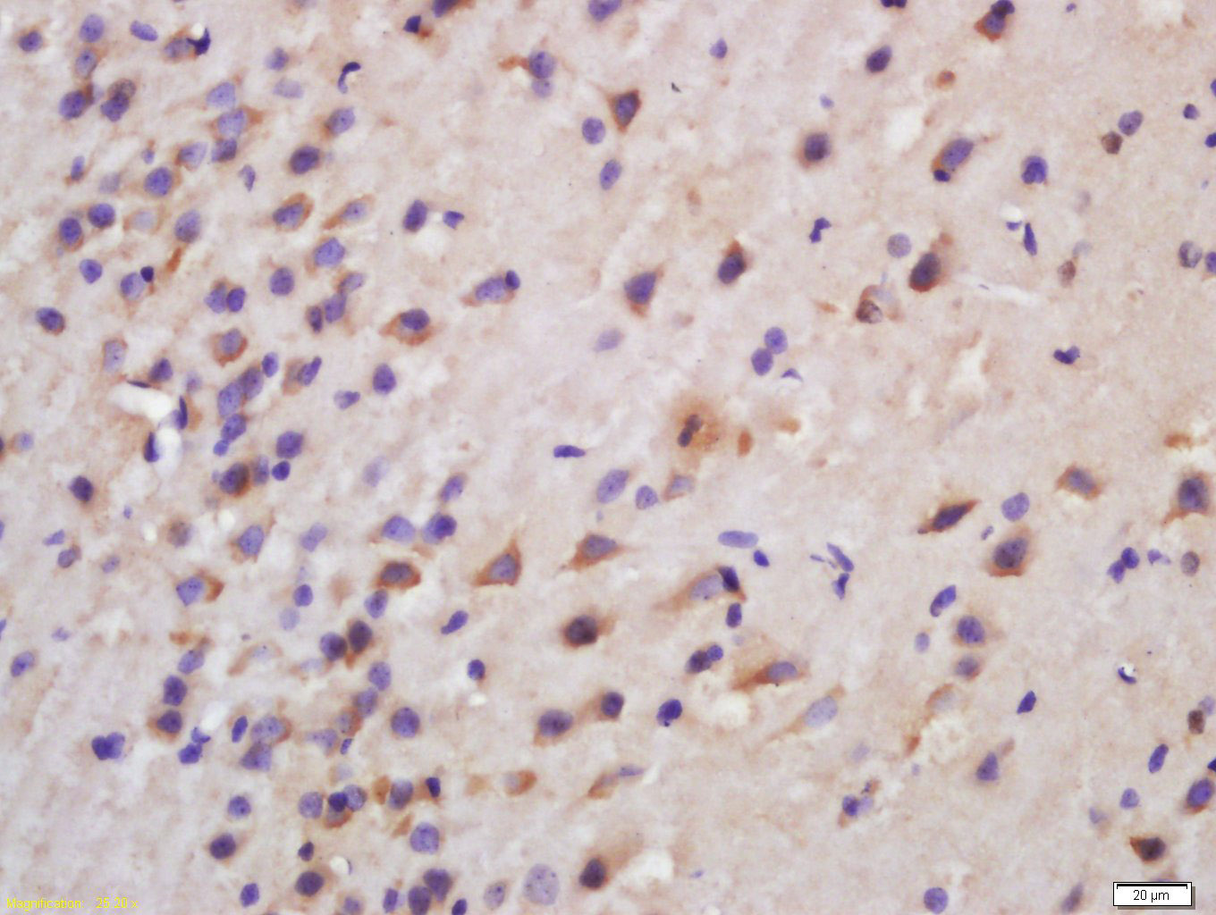 14 - Ceramide synthase 1 Rabbit pAb AP58273