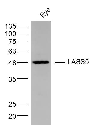 1 - LASS5 Rabbit pAb AP58274