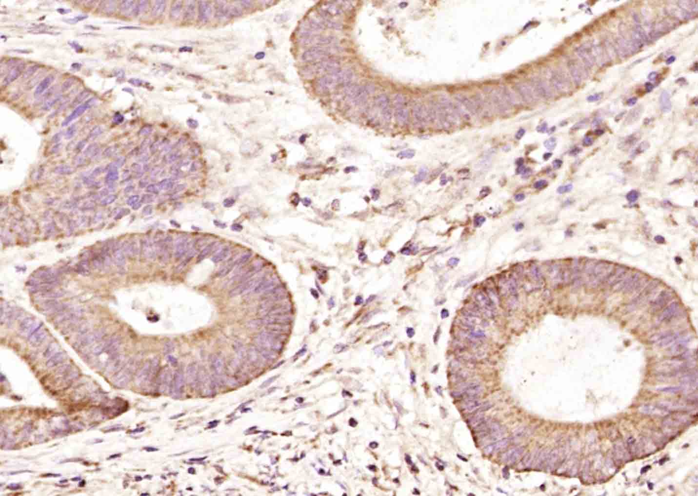 14 - PTPMT1 Rabbit pAb AP58280