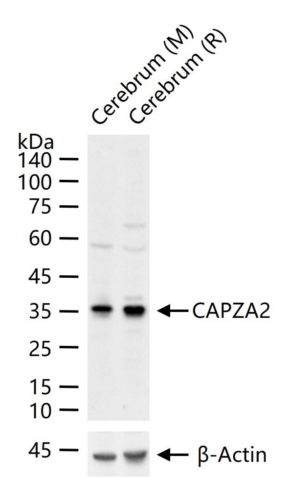 1 - CAPZA2 Rabbit pAb AP58285