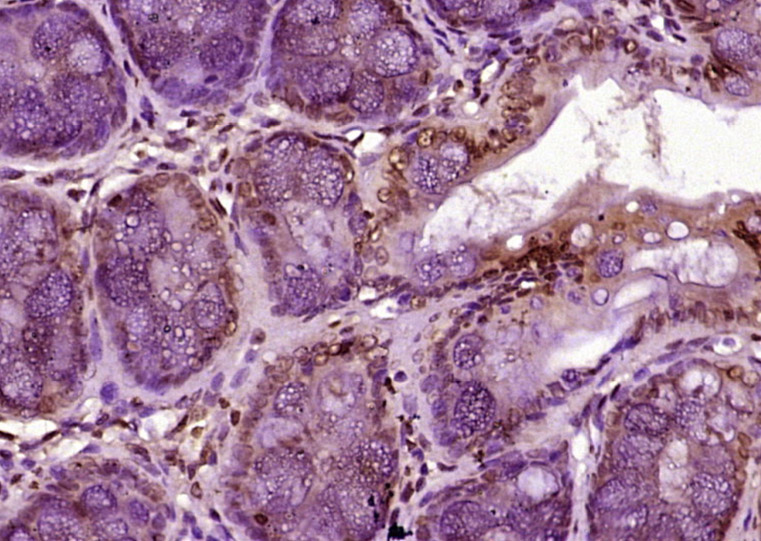 14 - MATR3 Rabbit pAb AP58288