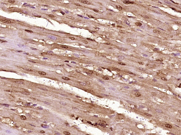 14 - proBNP Rabbit pAb AP58290