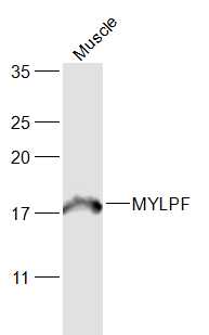 1 - MYLPF Rabbit pAb AP58291