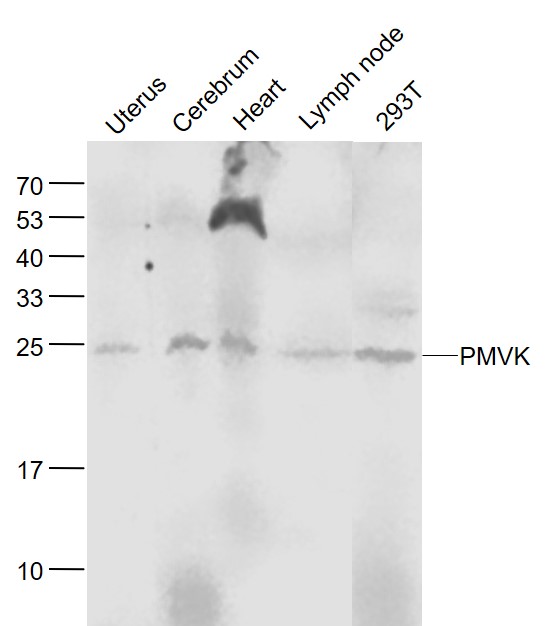 1 - PMVK Rabbit pAb AP58293