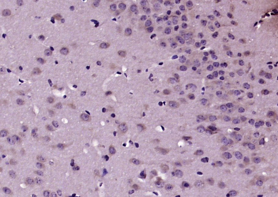 14 - TRAK1 Rabbit pAb AP58294