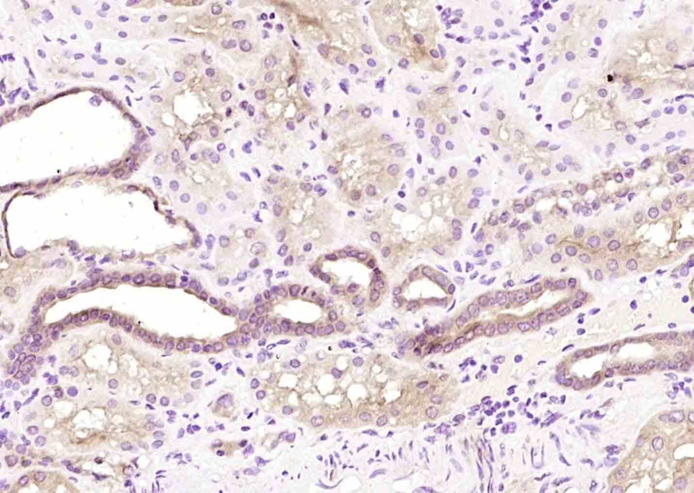 14 - TACC2 Rabbit pAb AP58302