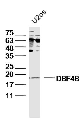 1 - DBF4B Rabbit pAb AP58303