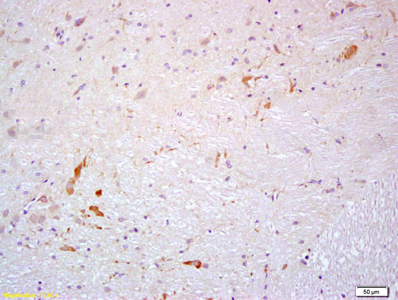 14 - PROK2 Rabbit pAb AP58312