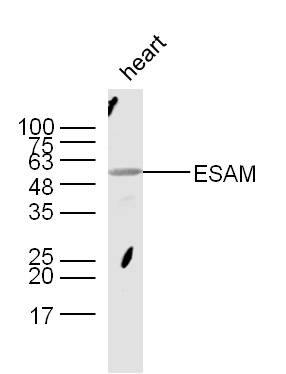 1 - ESAM Rabbit pAb AP58327