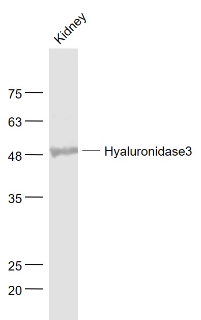 1 - Hyaluronidase3 Rabbit pAb AP58341