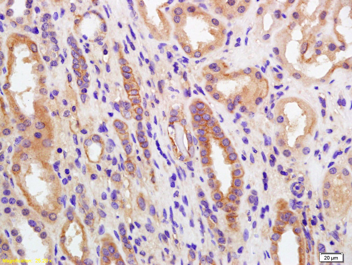 14 - PGRMC Rabbit pAb AP58346