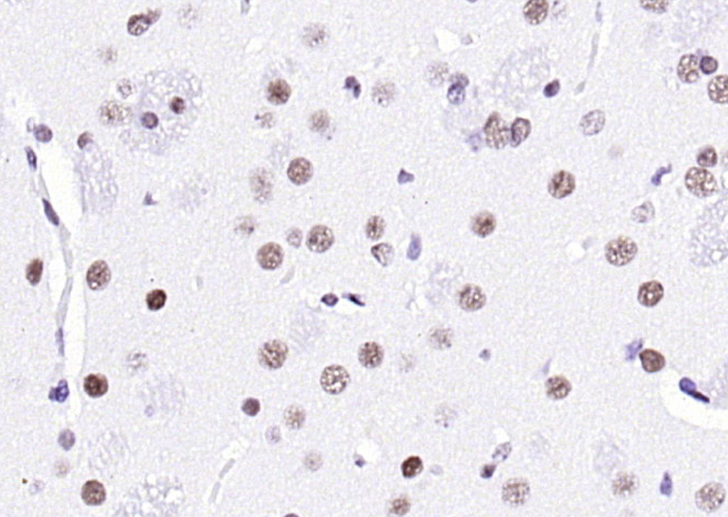 14 - KLHL7 Rabbit pAb AP58348