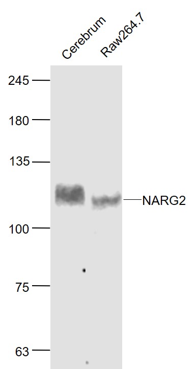 1 - NARG2 Rabbit pAb AP58352
