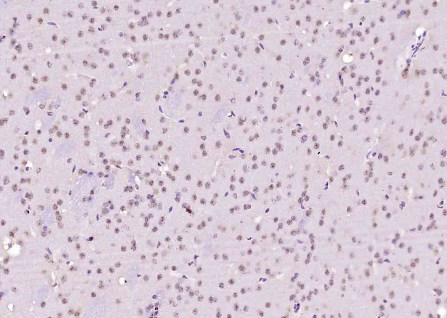 14 - NARG2 Rabbit pAb AP58352
