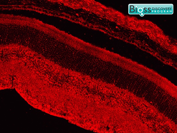 3 - CAMTA1 Rabbit pAb AP58356