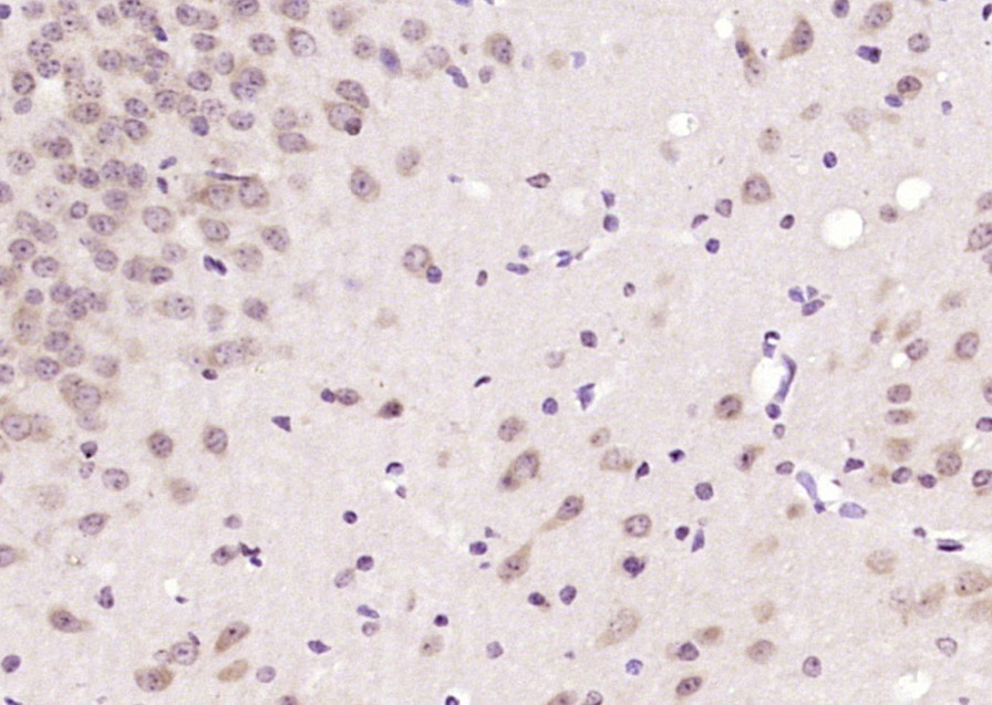 14 - CAMTA1 Rabbit pAb AP58356