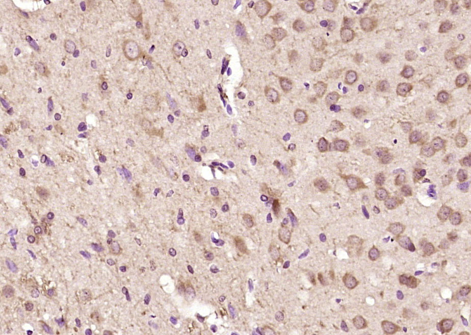 14 - FBXO31 Rabbit pAb AP58358