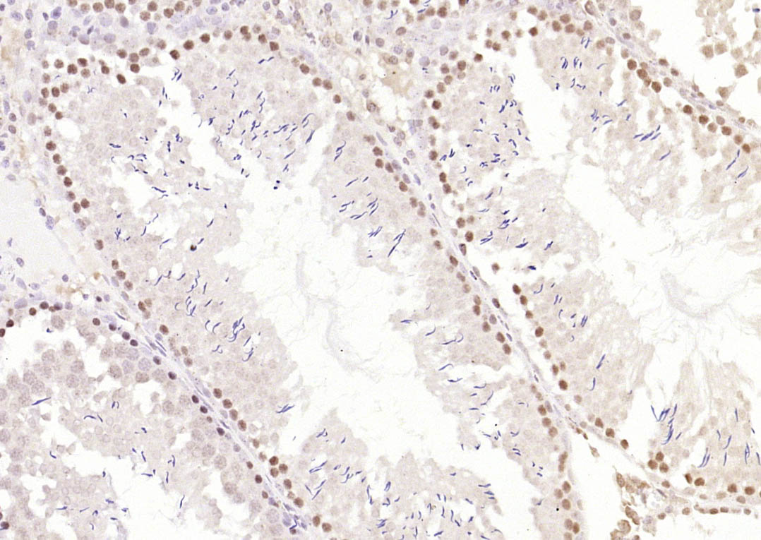 14 - METTL11A Rabbit pAb AP58368